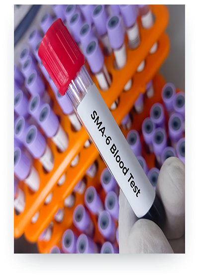 Evlilik Öncesi Spinal Musküler Atrofi (SMA) Taşıyıcı Tarama Programı