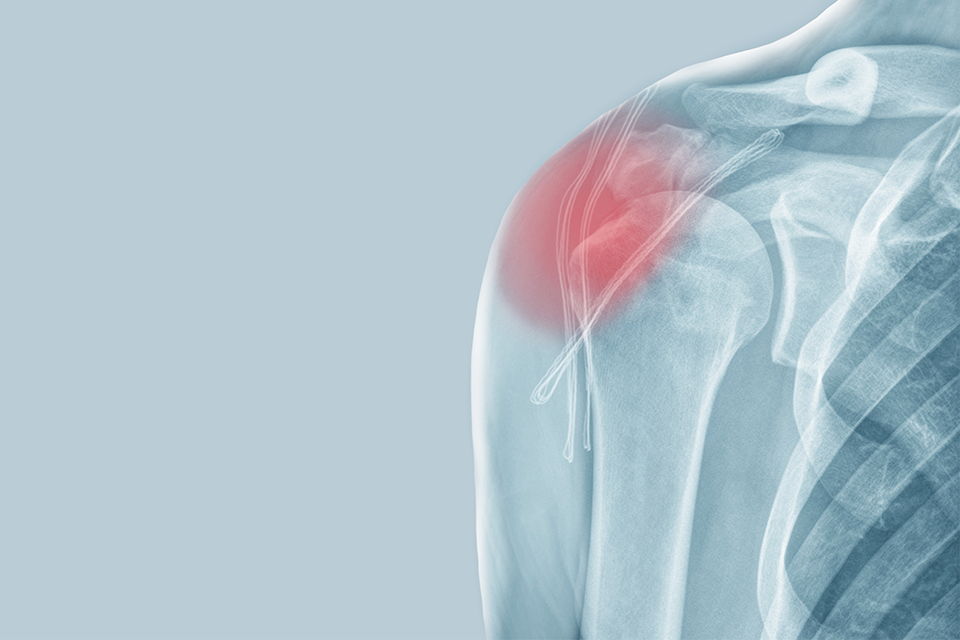 Image is not available