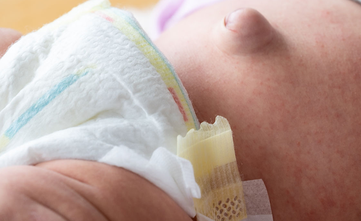 Göbek Fıtığı ve Kasık Fıtığı