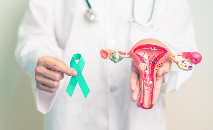 Over (Yumurtalık) Kanseri