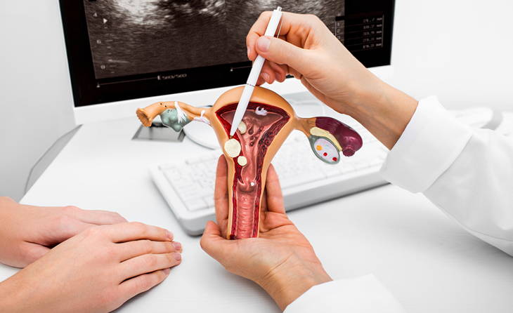 Rahim (Endometrium) Kanseri