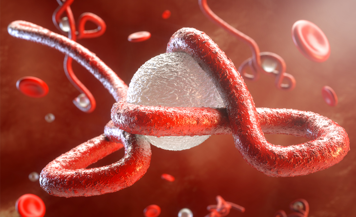 Ebola Virüs Hastalığı