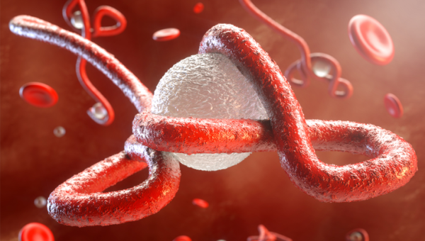 Ebola Virüs Hastalığı