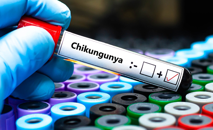 Chikungunya Ateşi