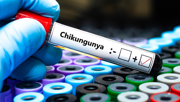 Chikungunya Ateşi